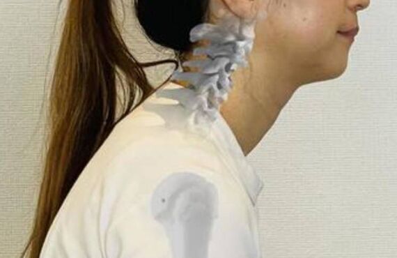 肩こり・ストレートネックでお悩みの方へ｜HILO BODYCARE STUDIO(港北区大倉山)
